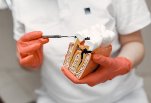 What Is an Endodontist? A Real-World Guide to the Dentist